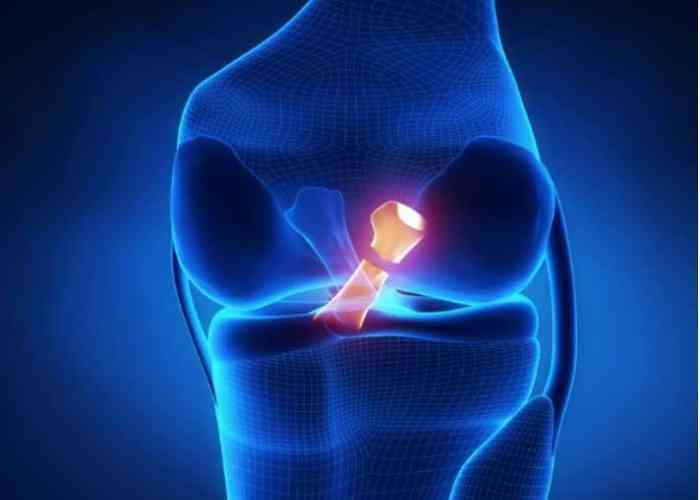 ACL Injury | Vail CO