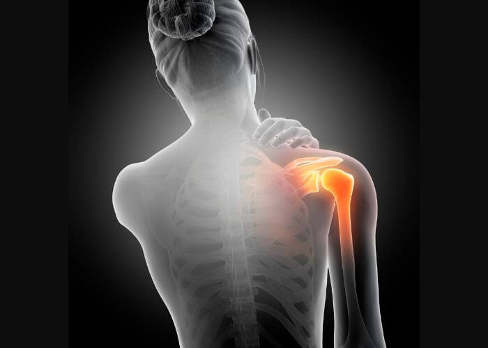 Denver Shoulder Pain Specialist - Well Beings Integrative Medicine