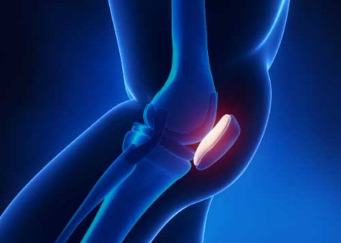 Patellofemoral Joint Pain | Vail CO